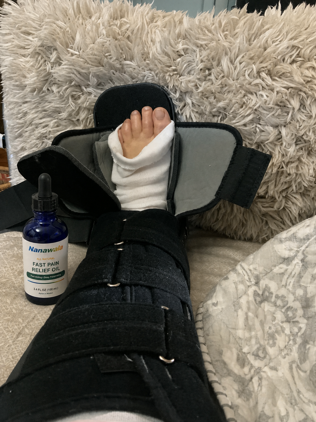 Tessa B. with Nanawala during ankle recovery